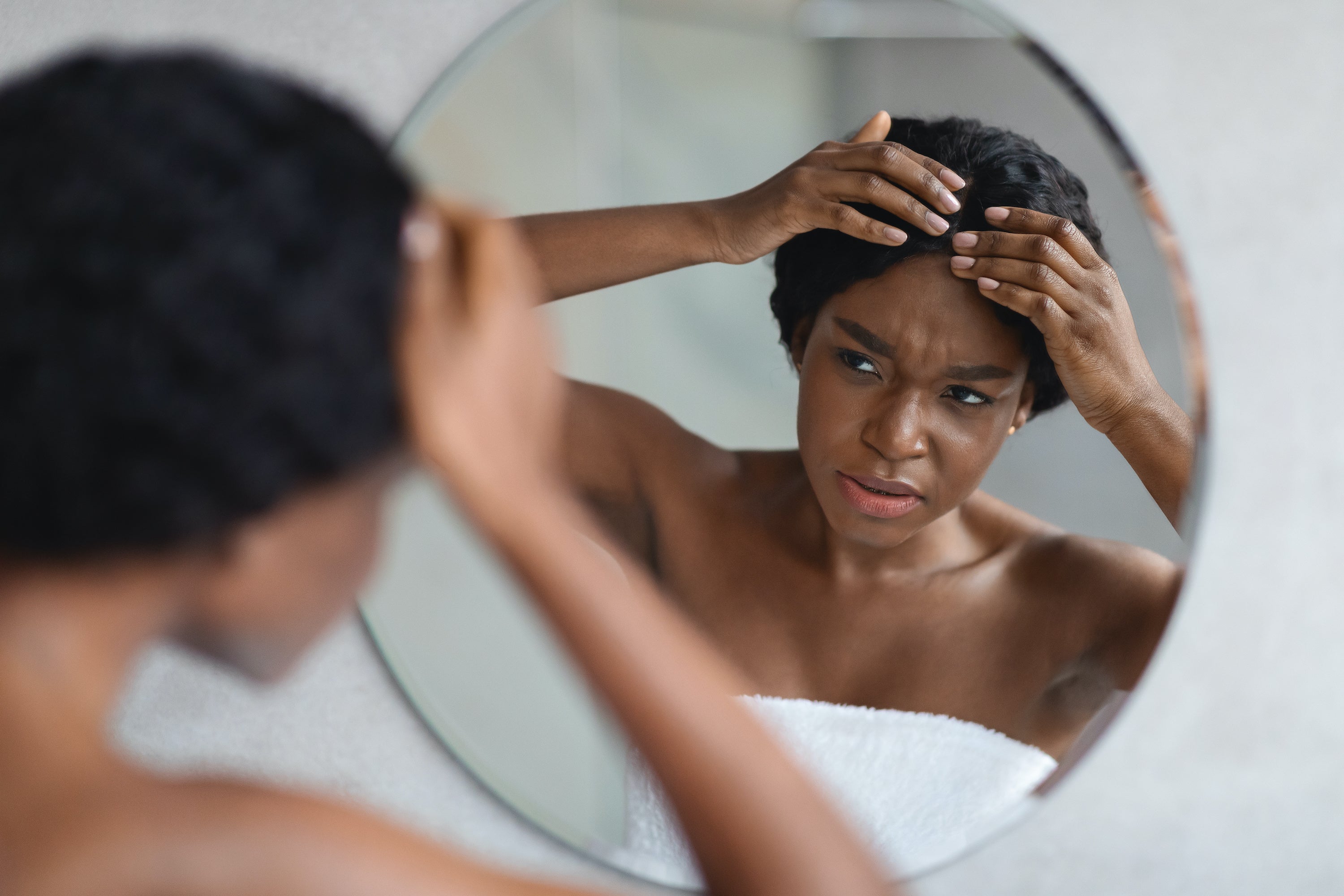 Stop Hair Loss Now: Understanding Traction Alopecia