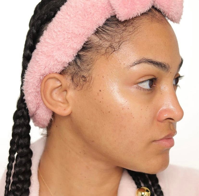 Woman with glowing skin wearing a pink headband and braided hair looking off camera.